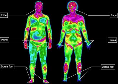 A Preliminary Study on Infrared Thermograph of Metabolic Syndrome